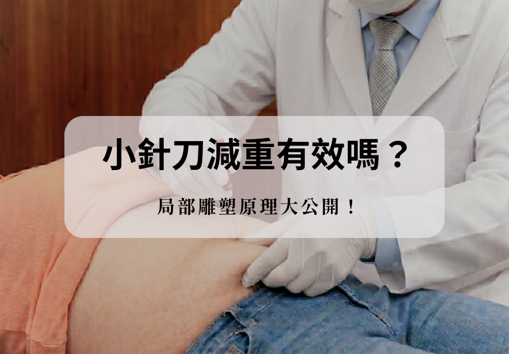 中醫師施作小針刀進行腹部局部雕塑，解析小針刀減重原理與功效。