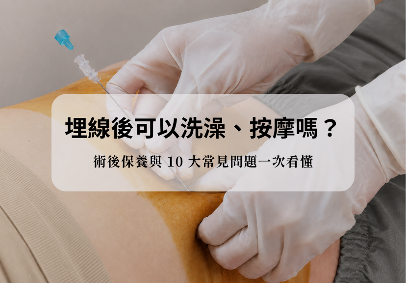 中醫埋線術後保養示意,醫師進行腹部埋線療程,解析洗澡、按摩與術後照護注意事項。