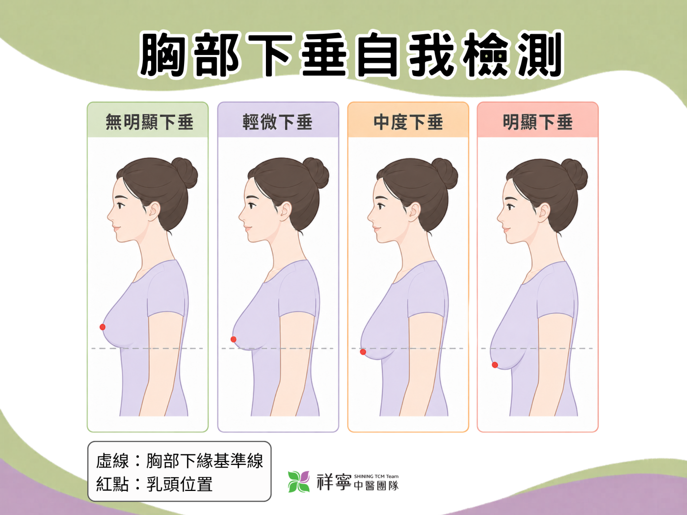 胸部下垂自我檢測圖,說明無明顯、輕微、中度與明顯下垂的胸型判斷方式。