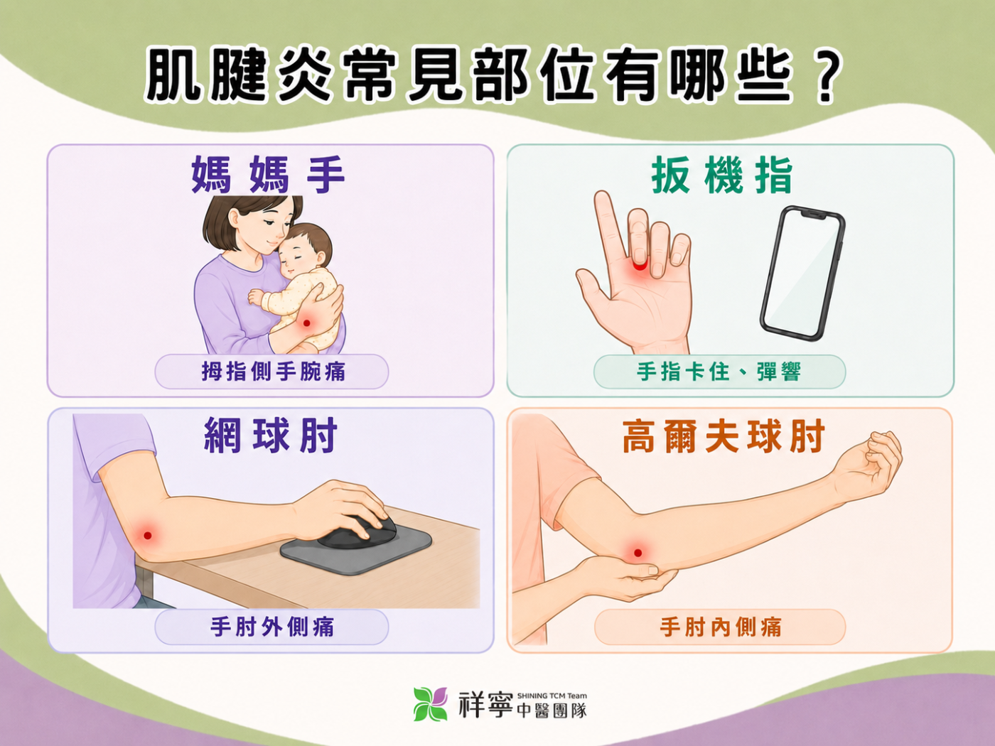 肌腱炎常見部位說明圖,整理媽媽手、板機指、網球肘與高爾夫球肘等手部疼痛情境。