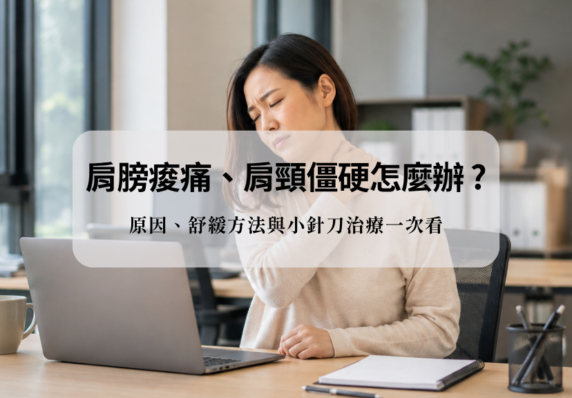 肩膀痠痛與肩頸僵硬情境,說明常見原因、舒緩方法與小針刀評估重點。