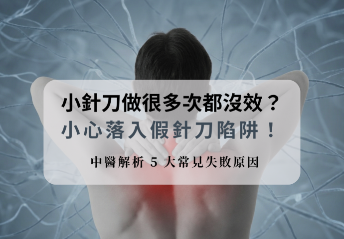 小針刀做很多次都沒效？小心落入「假針刀」陷阱！中醫解析 5 大常見失敗原因