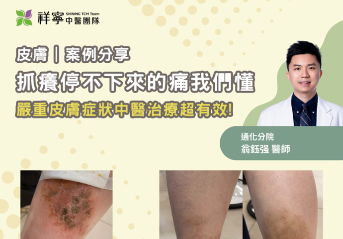 告別搔癢！中醫治皮膚超有效