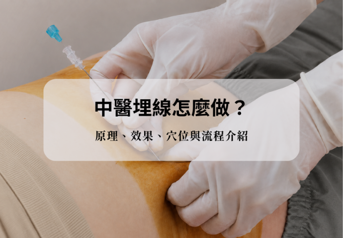 中醫埋線怎麼做？原理、效果、穴位與流程介紹