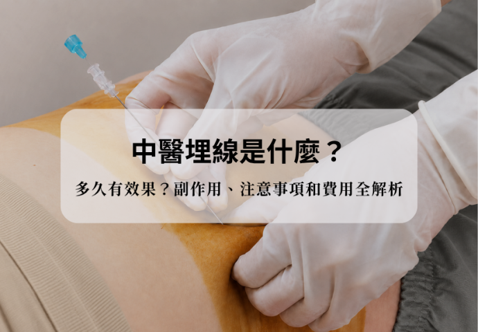 中醫埋線是什麼？多久有效果？副作用、注意事項和費用全解析
