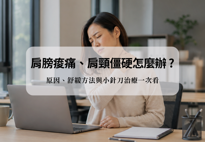 肩膀痠痛、肩頸僵硬怎麼辦？原因、舒緩方法與小針刀治療一次看
